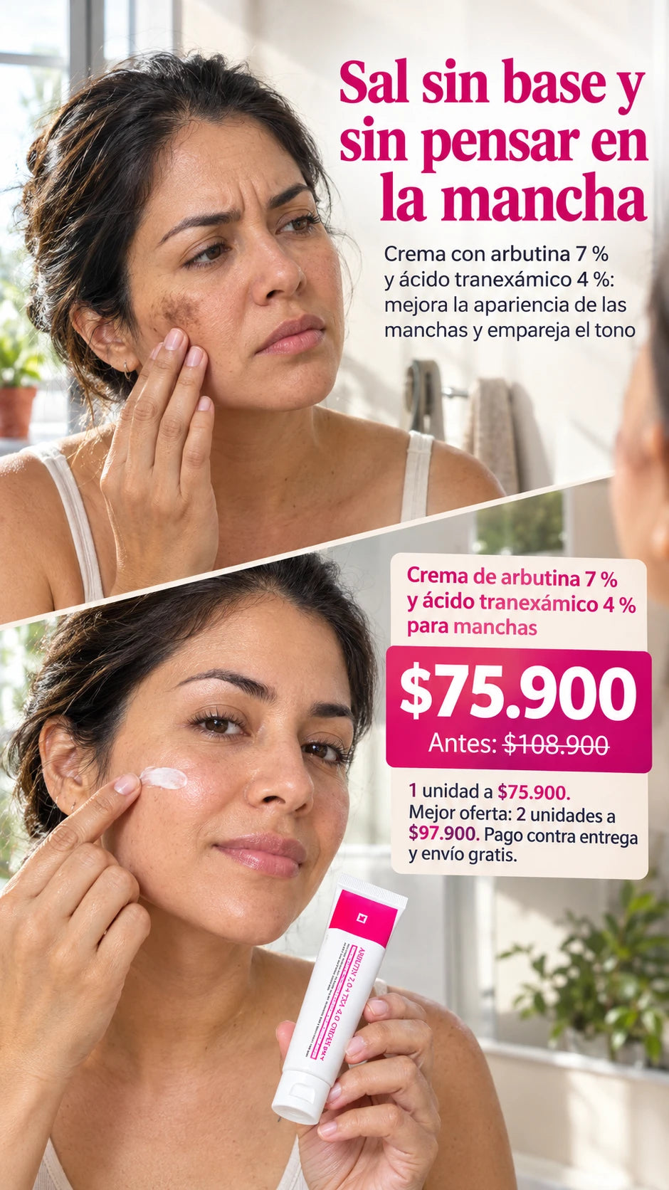Crema de arbutina 7 % y ácido tranexámico 4 % para manchas